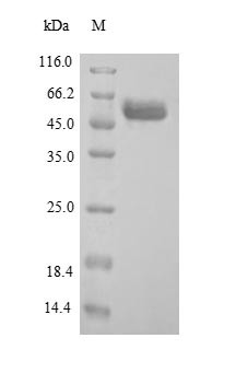 Arylsulfatase B (ARSB), human, recombinant