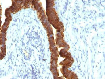 Anti-Ep-CAM / CD326 (Epithelial Marker) Recombinant Mouse Monoclonal Antibody (clone:rEGP40/1110)