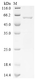 Proteasome activator complex subunit 3 (PSME3), partial, human, recombinant