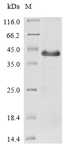 Interferon lambda receptor 1 (IFNLR1), partial, human, recombinant