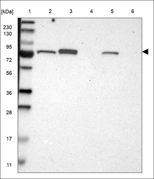 Anti-NTN4