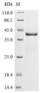 Major capsid protein VP1, Murine polyomavirus, recombinant