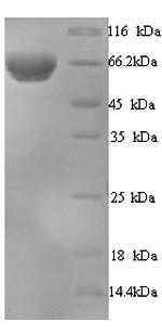 Interferon-induced, double-stranded RNA-activated protein kinase (EIF2AK2), human, recombinant