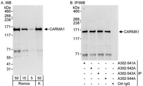 Anti-CARMA1