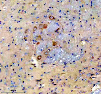 Anti-NCR2 / Natural cytotoxicity triggering receptor 2, clone 27N49