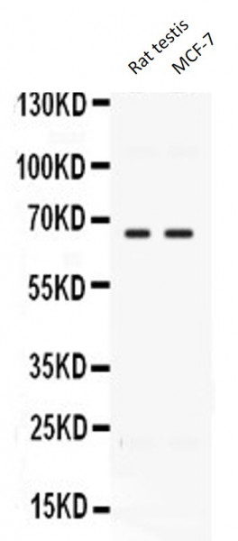 Anti-CCDC6