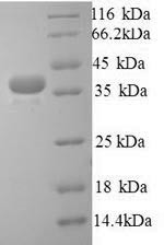 Talin-1 (TLN1), partial, human, recombinant