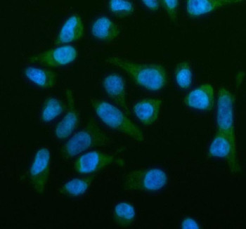 Anti-OSBPL2 / Oxysterol-binding protein-like 2