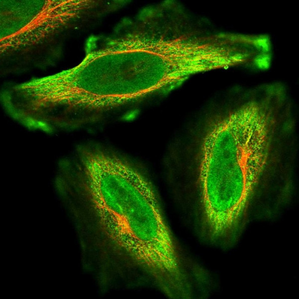 Anti-KIF26A