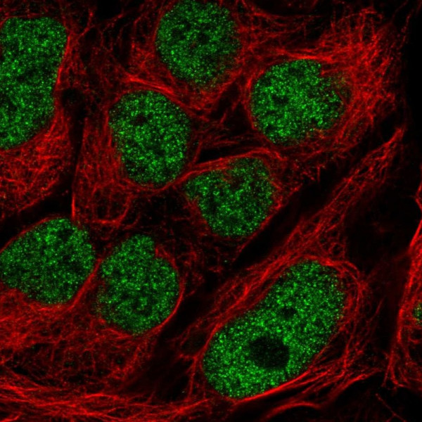 Anti-GMEB2