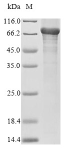 5-Aminolevulinate synthase, nonspecific, mitochondrial (Alas1), mouse, recombinant