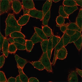 Anti-SCXA / Scleraxis, clone PCRP-SCXA-2D11
