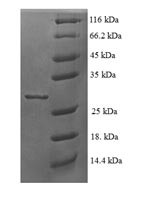 60S ribosomal protein L35a (RPL35A), human, recombinant