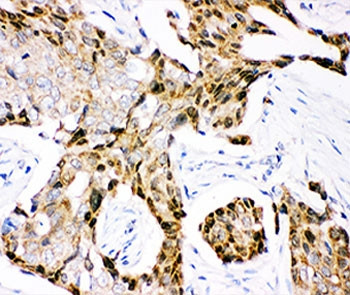 Anti-Ubiquitin