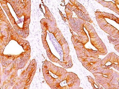 Anti-Cytokeratin, pan(AE-1 / AE-3), Biotin conjugate, 0.1mg/mL