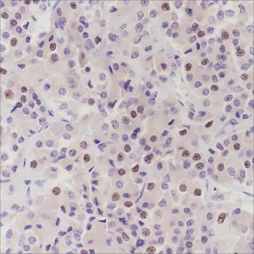 Anti-Recombinant PITX2/RGS, clone A334