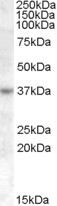 Anti-RASSF7 / HRAS1, Internal