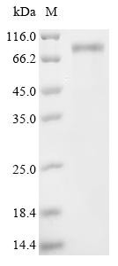 Semenogelin-2 (SEMG2), recombinant human