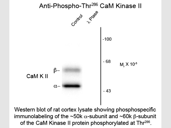 Anti-phospho-CaM Kinase II (Thr286)