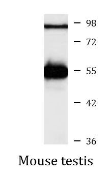 Anti-ABI1 / SSH3BP1