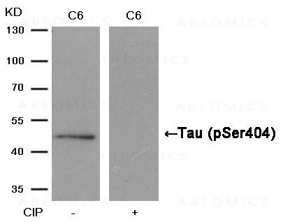 Anti-phospho-Tau (Ser404)