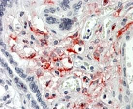 Anti-HCP1