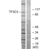 Anti-GTF3C3