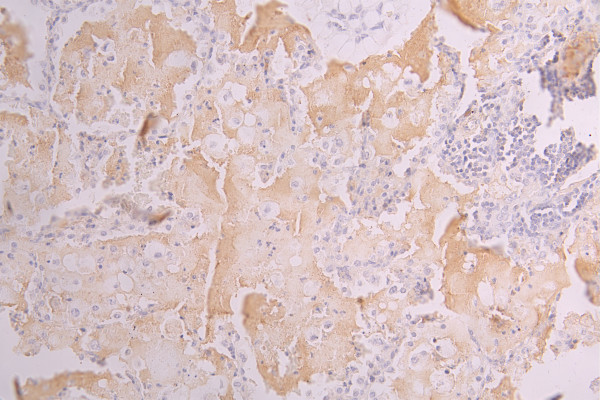 Anti-AOC3, recombinant clone 3D3