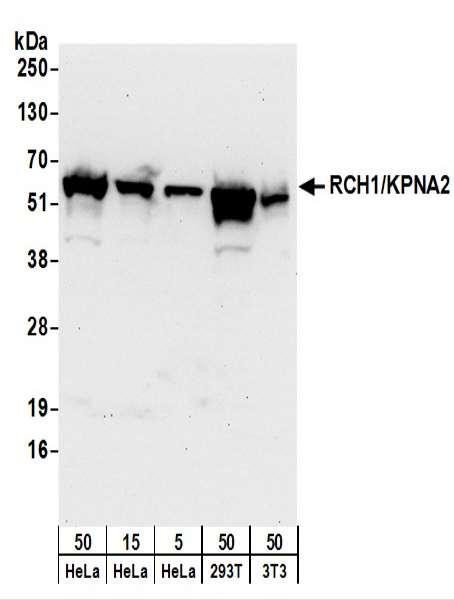 Anti-RCH1/KPNA2