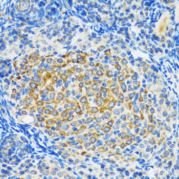 Anti-SIRT2