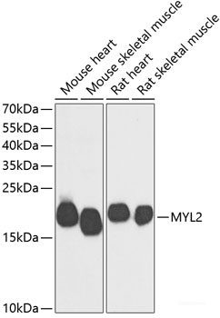 Anti-MYL2