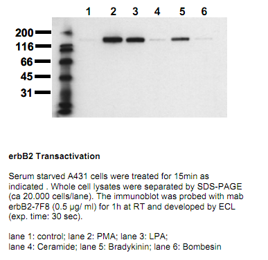 Anti-phospho-ErbB2 (Thr686), clone 7F8