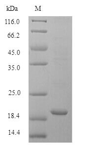 Bis (5'-adenosyl)-triphosphatase (Fhit), mouse, recombinant