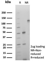 Anti-CD39 / ENTPD1 (Marker of Tumor-specific T cells), recombinant antibody, clone rCD39/8682