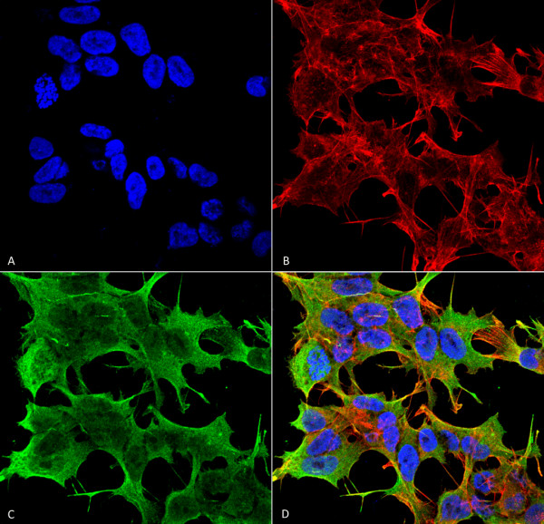 Anti-GluR1, clone S355-1