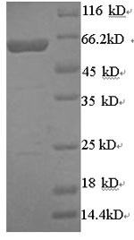 Arylsulfatase B (ARSB), human, recombinant