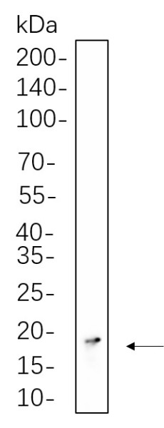 Anti-Recombinant Histone H3 (Tri Methyl Lys36), clone 5C2