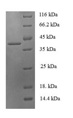 14KDA phosphohistidine phosphatase (PHPT1), human, recombinant