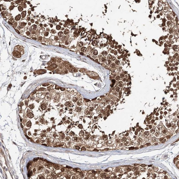 Anti-INPP4B