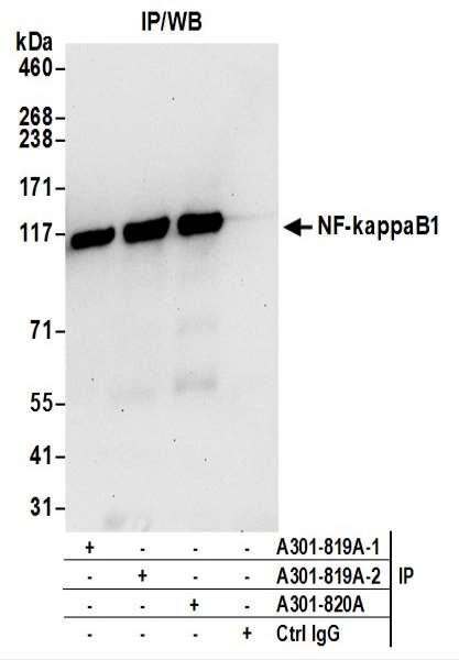 Anti-NF-kappaB1