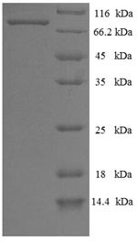Nucleoprotein (NP), Influenza B virus, recombinant
