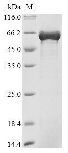 Zinc finger protein ZPR1 (ZPR1), human, recombinant
