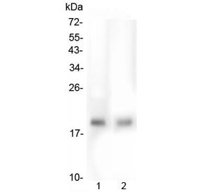 Anti-TMEM166 / EVA1A
