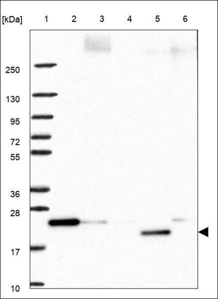 Anti-DCTPP1