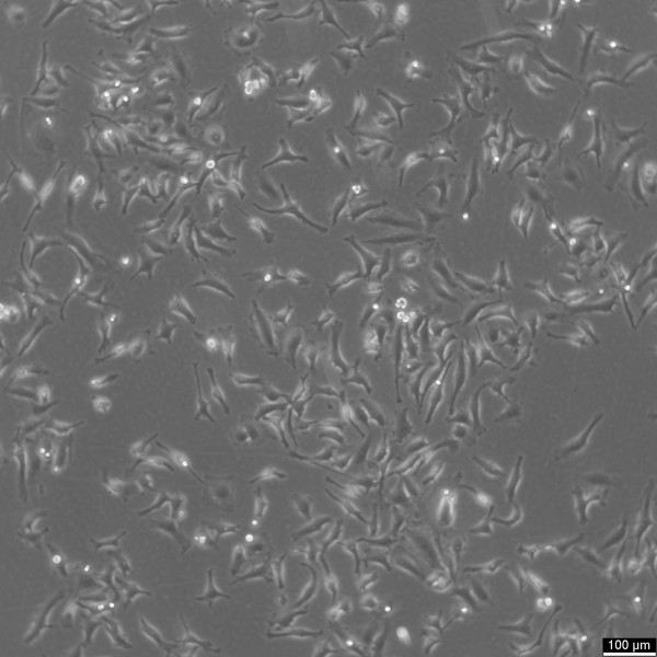 HEp-2 Cells