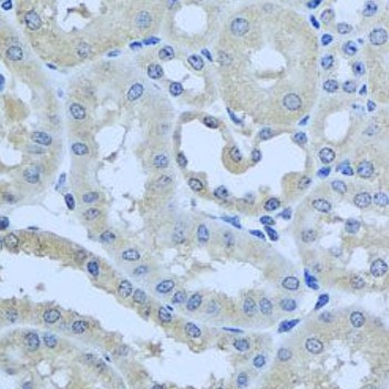 Anti-CHMP1B