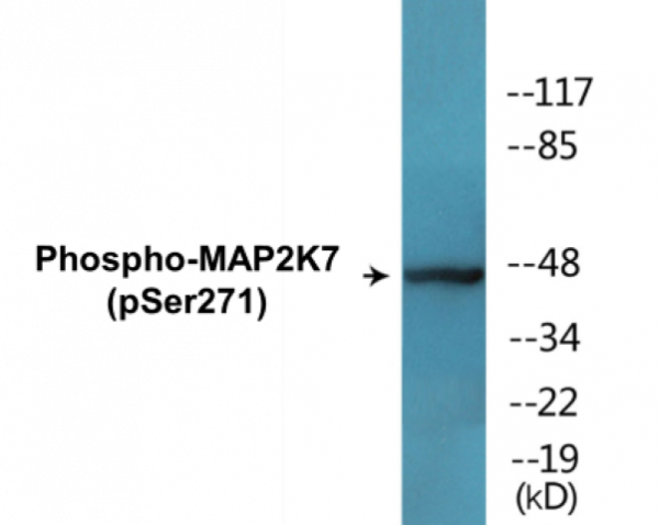 MAP2K7 (Phospho-Ser271) Colorimetric Cell-Based ELISA Kit