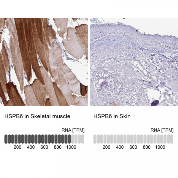 Anti-HSPB6