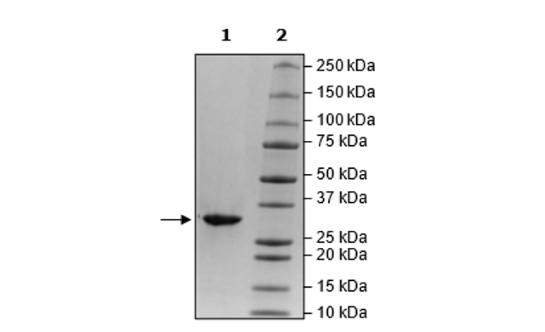 3CL Protease (T21I, E166V) (SARS-CoV-2) Recombinant