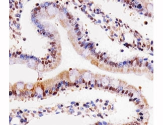 Anti-Cdk4